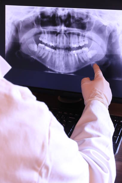 Best After-Hours Emergency Dentist in Chackbay, LA